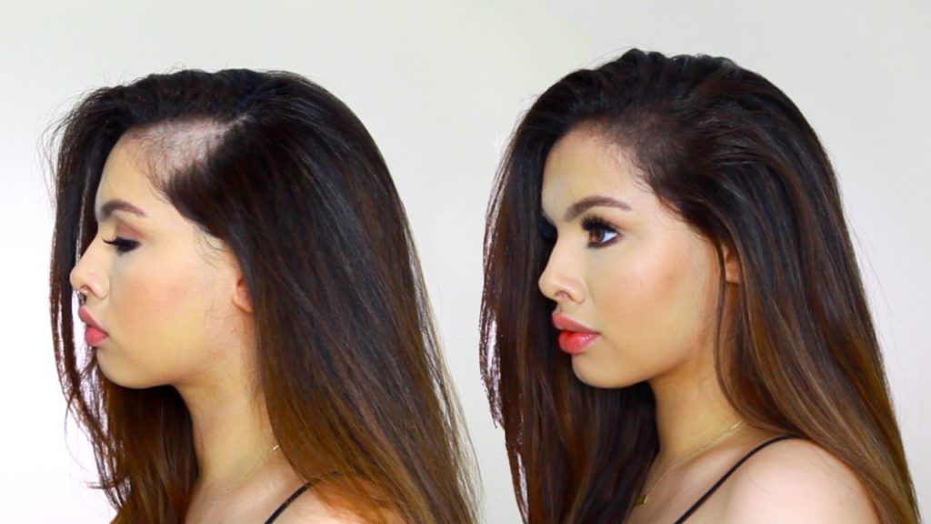 5 Pure Methods You Can Stop Undesirable Hair Fall